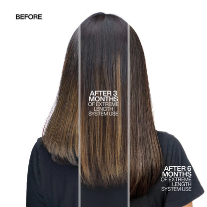 Extreme Length Set - US 5174
